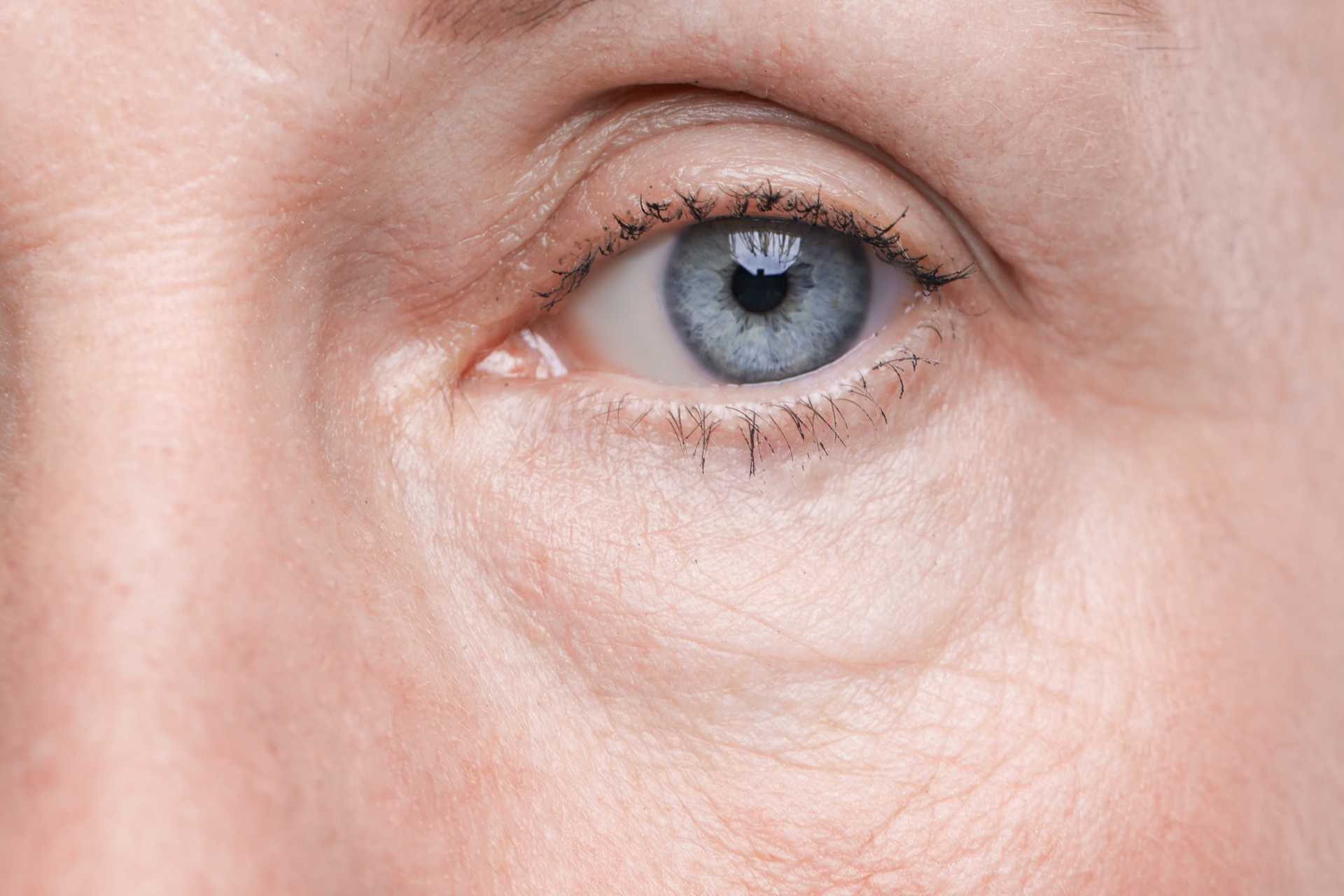 Ageing Women Eye