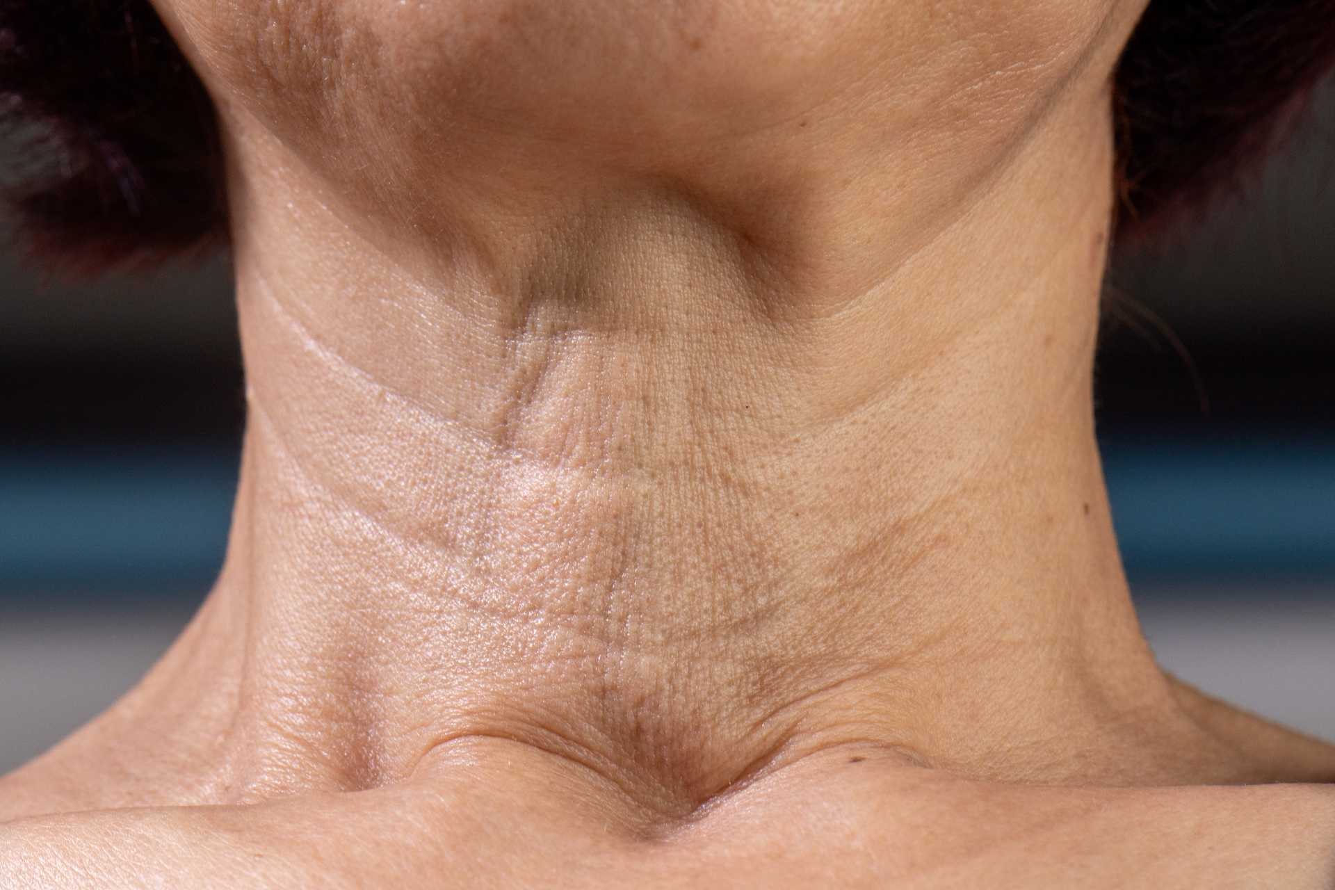 Ageing Women Neck