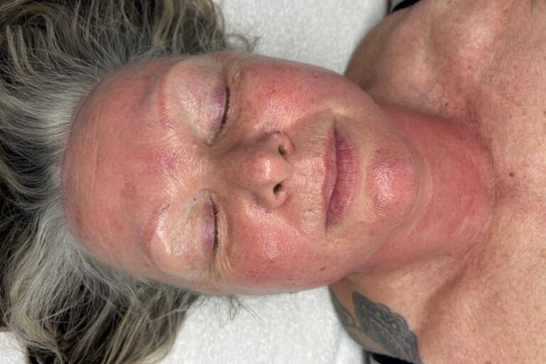 Collagen Lift Full Face