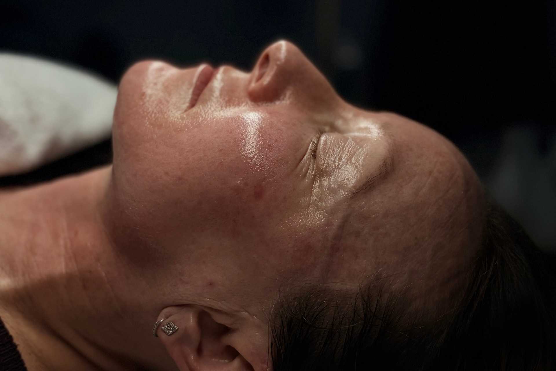 Collagen Lift Left Side Post Treatments