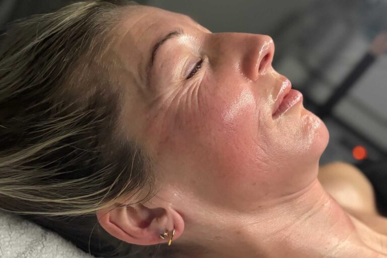 Collagen Lift Right Side Post Treatments
