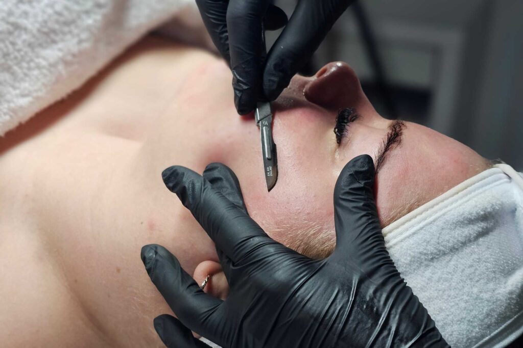 Dermaplaning Woman Chin